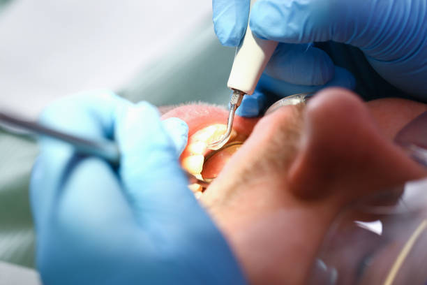 Best Emergency Root Canal Treatment in Pottsboro, TX